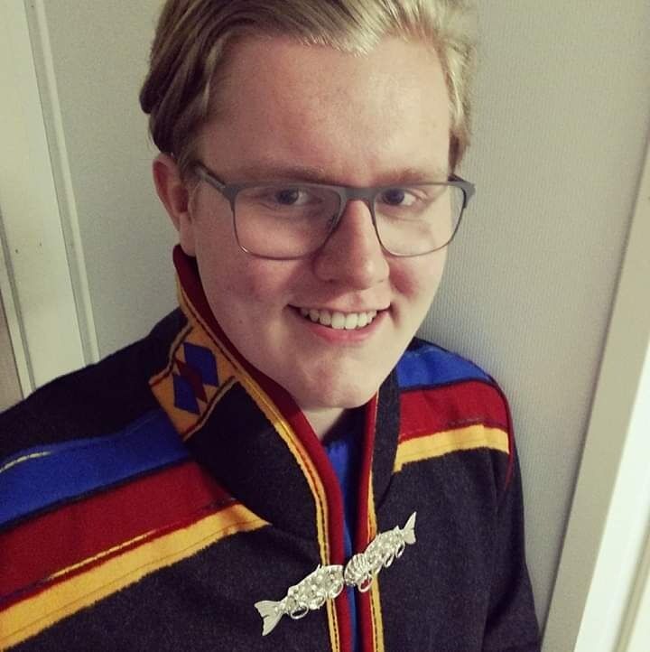 Fredag kveld ble Jon-Richard Sommernes slått hardt i ansiktet av en ukjent mann i Tromsø.  Voldsmannen forklarte angrepet med at han hadde lyst til å slå en same.
 Foto: Privat