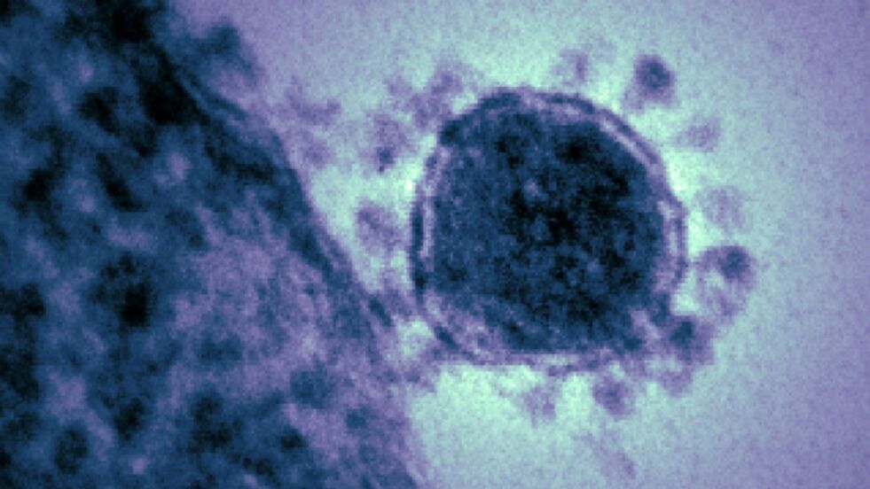 Dagbladet skriver at til nå har 26 personer mistet livet som følge av utbruddet av coronaviruset. 830 sykdomstilfeller er påvist, i følge kinesiske myndigheter. ILLUSTRASJONSFOTO: FOLKEHELSEINSTITUTTET
